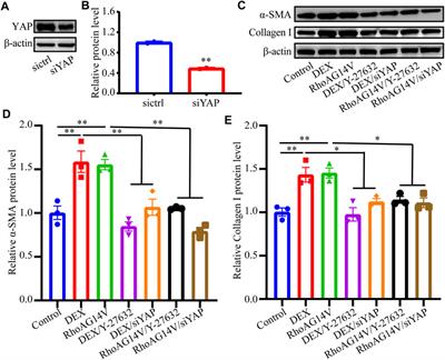 RhoA/ROCK-YAP/TAZ Axis Regulates the Fibrotic Activity in Dexamethasone-Treated Human Trabecular Meshwork Cells